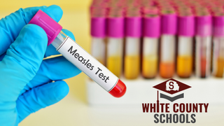Confirmed Measles case reported in White County Schools